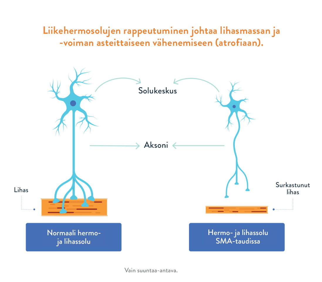 Kaavio spinaalisen lihasatrofian aiheuttajasta